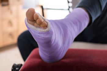 foot and ankle fractures treatment in the Ocean County, NJ: Toms River (Brick Township, Jackson Township, Berkeley Township, Lacey Township, Ocean Township, Beachwood) areas